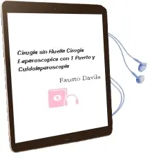 Descargar AudioLibro Cirugia sin Huella. Cirugia Laparoscopica con 1 Puerto y Culdolaparoscopia de Fausto Davila año 2013