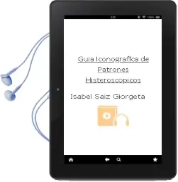 Descargar AudioLibro Guia Iconografica de Patrones Histeroscopicos de Isabel Saiz Giorgeta año 2013